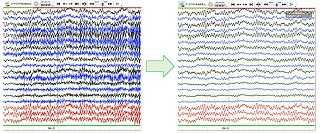 脳波計 EEG-1200シリーズ ニューロファックス（EEG-1260 Next
