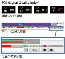 eeg 2012年 EEG皿電極 成人・小児用 TypeV｜消耗品・オプション品｜フクダ